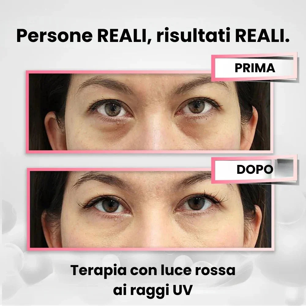 Massaggiatore Occhi Revitalizzante + Crema anti Rughe in OMAGGIO